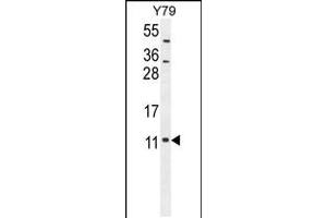 Western blot analysis in Y79 cell line lysates (35ug/lane). (NDUFA11 抗体  (AA 64-92))