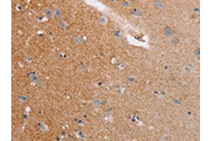 The image on the left is immunohistochemistry of paraffin-embedded Human brain tissue using ABIN7128771(CASC3 Antibody) at dilution 1/20, on the right is treated with fusion protein. (CASC3 抗体)