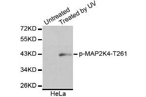 Western blot analysis of extracts of HeLa cells, using Phospho-MAP2K4-T261 antibody (ABIN5995644). (MAP2K4 抗体  (pThr261))
