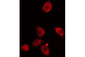 ABIN6274133 staining HeLa cells by IF/ICC. (ZNF265 抗体  (Internal Region))