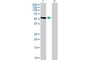 Western Blot analysis of CRTAC1 expression in transfected 293T cell line by CRTAC1 MaxPab polyclonal antibody. (CRTAC1 抗体  (AA 1-451))
