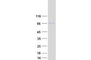 Validation with Western Blot