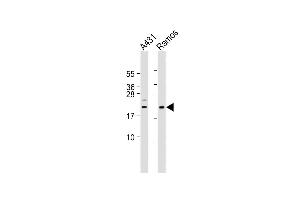 All lanes : Anti-hBik-BH3 at 1:2000 dilution Lane 1: A431 whole cell lysate Lane 2: Ramos whole cell lysate Lysates/proteins at 20 μg per lane. (BIK 抗体  (AA 39-74))