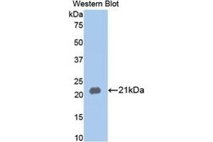 Detection of Recombinant MMP13, Rabbit using Polyclonal Antibody to Matrix Metalloproteinase 13 (MMP13)