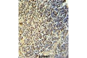 Immunohistochemistry (IHC) image for anti-Nuclear Receptor Subfamily 5, Group A, Member 1 (NR5A1) antibody (ABIN3002239)
