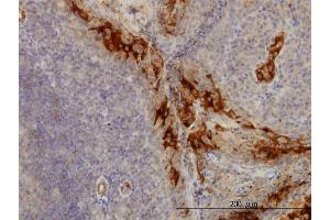 Immunostaining (ISt) image for anti-Tumor Necrosis Factor Receptor Superfamily, Member 6b, Decoy (TNFRSF6B) (AA 32-141) antibody (ABIN563778)