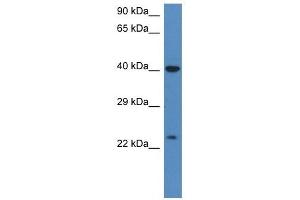 Western Blot showing PRSS1 antibody used at a concentration of 1 ug/ml against HT1080 Cell Lysate (PRSS1 抗体  (C-Term))