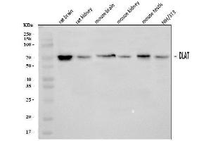 Western blot analysis of DLAT using anti-DLAT antibody (ABIN7602307).