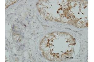 Image no. 3 for anti-A Kinase (PRKA) Anchor Protein 10 (AKAP10) (AA 1-101) antibody (ABIN599175) (AKAP10 抗体  (AA 1-101))