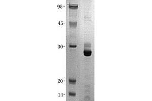 Validation with Western Blot (CDKN1B Protein (His tag))