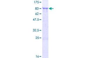 TBCD Protein (AA 1-623) (GST tag)