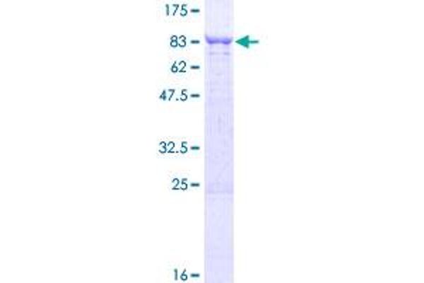TBCD Protein (AA 1-623) (GST tag)