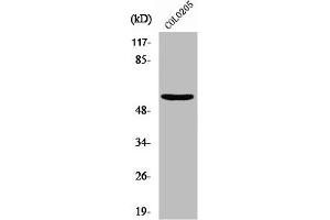 Western Blot analysis of HeLa cells using Neuroglycan C Polyclonal Antibody (CSPG5 抗体  (Internal Region))