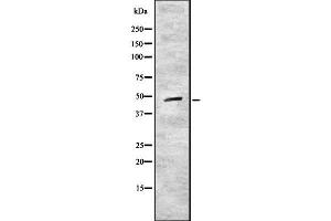 Western blot analysis of CRLF1 using COS7 whole cell lysates (CRLF1 抗体)