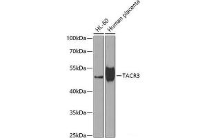 Western blot analysis of extracts of various cell lines using TACR3 Polyclonal Antibody at dilution of 1:1000. (TACR3 抗体)