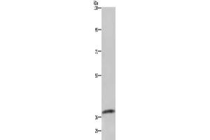 Gel: 6 % SDS-PAGE, Lysate: 40 μg, Lane: Mouse kidney tissue, Primary antibody: ABIN7129587(GDF3 Antibody) at dilution 1/250, Secondary antibody: Goat anti rabbit IgG at 1/8000 dilution, Exposure time: 1 minute (GDF3 抗体)