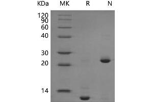 Western Blotting (WB) image for Transforming Growth Factor, beta 2 (TGFB2) (Active) protein (ABIN7320669) (TGFB2 蛋白)