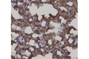 IHC analysis of RAGE/AGER using anti-RAGE/AGER antibody (ABIN7603153).