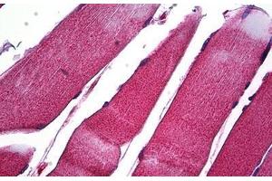 Human Skeletal Muscle: Formalin-Fixed, Paraffin-Embedded (FFPE) (MMP1 抗体  (C-Term))