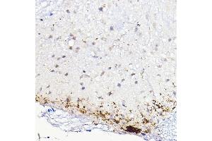 Immunohistochemistry of paraffin-embedded mouse spinal cord using CALCA Rabbit pAb (ABIN7266005) at dilution of 1:100 (40x lens). (CGRP 抗体  (AA 1-141))