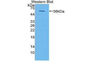 Western Blotting (WB) image for anti-Transmembrane Protein 27 (TMEM27) (AA 12-222) antibody (ABIN1871656) (TMEM27 抗体  (AA 12-222))