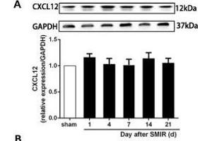 The CXCR7 and PI3K/Akt signaling pathways are involved in CPSP in the dorsal horn of the spinal cord. (GAPDH 抗体)