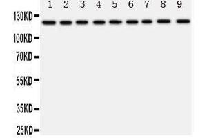 Western Blotting (WB) image for anti-Transient Receptor Potential Cation Channel, Subfamily C, Member 3 (TRPC3) (AA 836-851), (C-Term) antibody (ABIN3044145) (TRPC3 抗体  (C-Term))