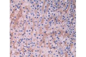 Used in DAB staining on fromalin fixed paraffin- embedded adrenal gland tissue (CYP17A1 抗体  (AA 183-508))