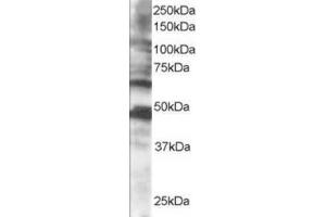 Image no. 1 for anti-Cytoplasmic Polyadenylation Element Binding Protein 1 (CPEB1) (C-Term) antibody (ABIN374439) (CPEB1 抗体  (C-Term))