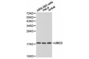 Western Blotting (WB) image for anti-Ubiquitin-Conjugating Enzyme E2I (UBE2I) antibody (ABIN1875255)
