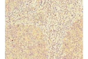 Immunohistochemistry of paraffin-embedded human tonsil tissue using ABIN7173532 at dilution of 1:100 (ADAT1 抗体  (AA 1-501))