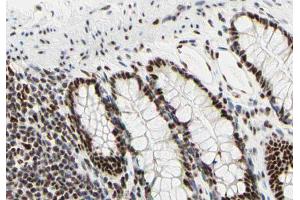 ABIN6266668 at 1/100 staining human colon tissue sections by IHC-P. (UBA2 抗体  (C-Term))