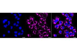 Immunocytochemical staining of HT- cells with P2RY6 antibody (ABIN7800076), 1:1,000).