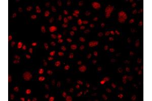 Immunofluorescence analysis of A549 cells using ARID1A antibody (ABIN5975837). (ARID1A 抗体)
