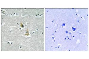Immunohistochemistry analysis of paraffin-embedded human brain tissue, using p47 phox (epitope around residue 345) antibody. (NCF1 抗体  (Ser345))