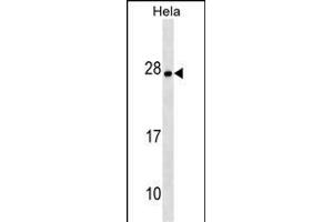 ZT4 Antibody (N-term) (ABIN1538915 and ABIN2849800) western blot analysis in Hela cell line lysates (35 μg/lane). (ZMAT4 抗体  (N-Term))