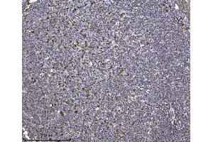 IHC analysis of SCA2/ATXN2 using anti-SCA2/ATXN2 antibody (ABIN7599900).