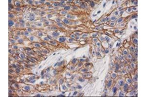 Image no. 1 for anti-Catenin (Cadherin-Associated Protein), beta 1, 88kDa (CTNNB1) antibody (ABIN1496894) (CTNNB1 抗体)