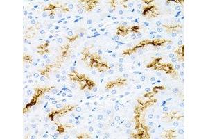 Immunohistochemistry of paraffin-embedded Rat kidney using IL17A Polyclonal Antibody at dilution of 1:100 (40x lens).