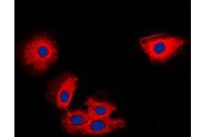 Immunofluorescent analysis of TIMP2 staining in MCF7 cells. (TIMP2 抗体  (Center))