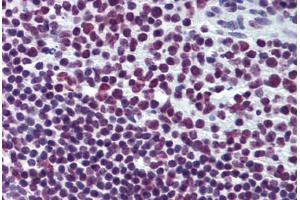 Human Tonsil: Formalin-Fixed, Paraffin-Embedded (FFPE) (EWSR1 抗体  (AA 358-454))