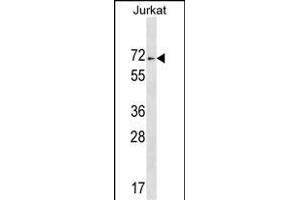 ZN Antibody (C-term) (ABIN1537425 and ABIN2849297) western blot analysis in Jurkat cell line lysates (35 μg/lane). (ZNF613 抗体  (C-Term))
