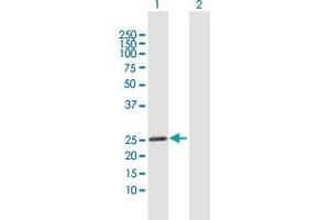 Western Blot analysis of GSTK1 expression in transfected 293T cell line by GSTK1 MaxPab polyclonal antibody. (GSTK1 抗体  (AA 1-226))