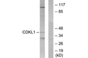 Western blot analysis of extracts from COLO205 cells, using CDKL1 Antibody. (CDKL1 抗体  (AA 281-330))