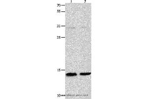 Western blot analysis of Jurkat and 231 cell  , using MYL9 Polyclonal Antibody at dilution of 1:1500
