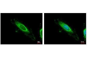 ICC/IF Image TBRG4 antibody detects TBRG4 protein at mitochondria by immunofluorescent analysis. (TBRG4 抗体)