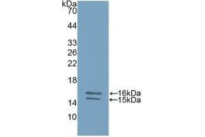 Detection of Recombinant IL23, Human using Polyclonal Antibody to Interleukin 23 Subunit Alpha (IL23a) (IL23A 抗体  (AA 20-189))