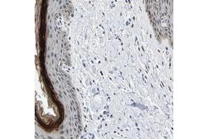 Immunohistochemical staining of human vulva/anal skin with C14orf177 polyclonal antibody  shows distinct positivity in stratum granulosum of squamous epithelium. (C14ORF177 抗体)