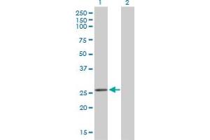 Western Blotting (WB) image for anti-Breast Carcinoma Amplified Sequence 2 (BCAS2) (AA 116-225) antibody (ABIN564463)