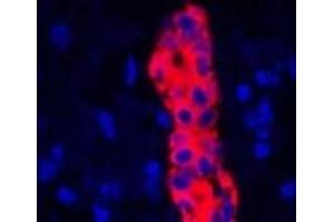 Immunofluorescence analysis of Human liver tissue using CK-19 Polyclonal Antibody at dilution of 1:200.